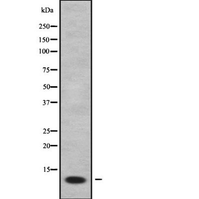 FXYD2 Antibody in Western Blot (WB)