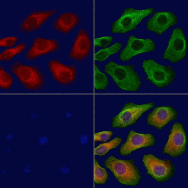 TBC1D2 Antibody in Immunocytochemistry (ICC/IF)