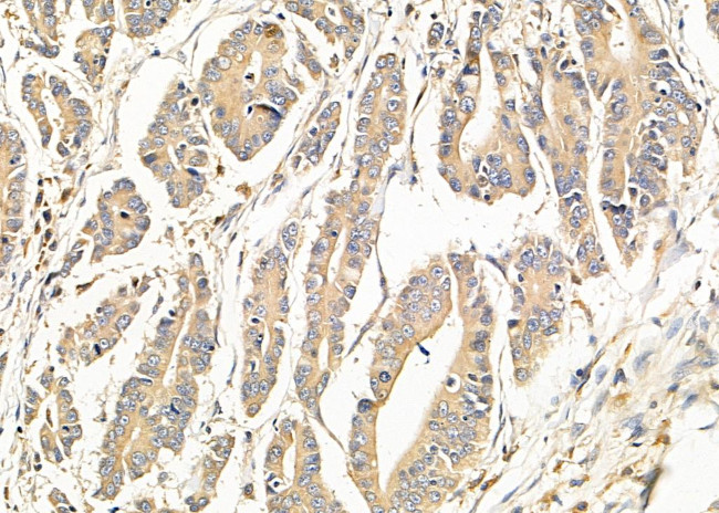 TBC1D2 Antibody in Immunohistochemistry (Paraffin) (IHC (P))