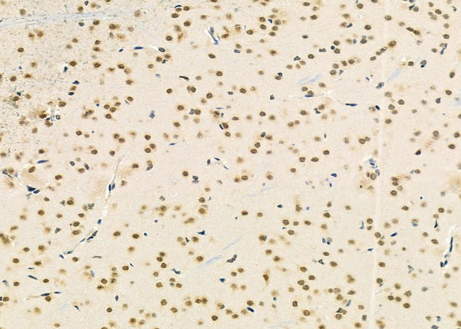 TCEAL2 Antibody in Immunohistochemistry (Paraffin) (IHC (P))