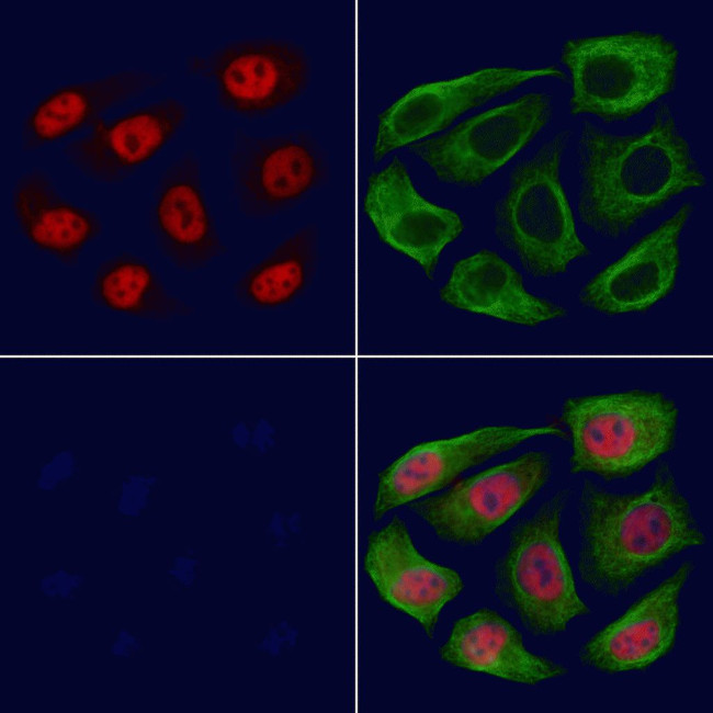 TCEAL5 Antibody in Immunocytochemistry (ICC/IF)