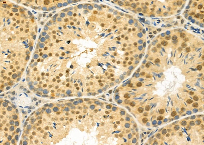 TCEAL5 Antibody in Immunohistochemistry (Paraffin) (IHC (P))