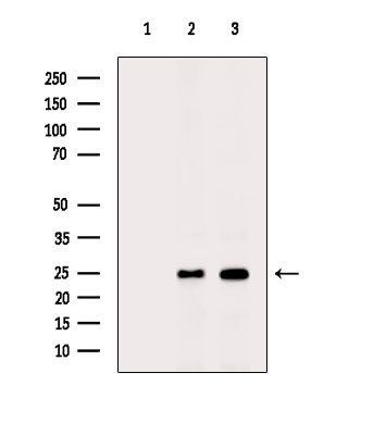 TCEAL8 Antibody in Western Blot (WB)