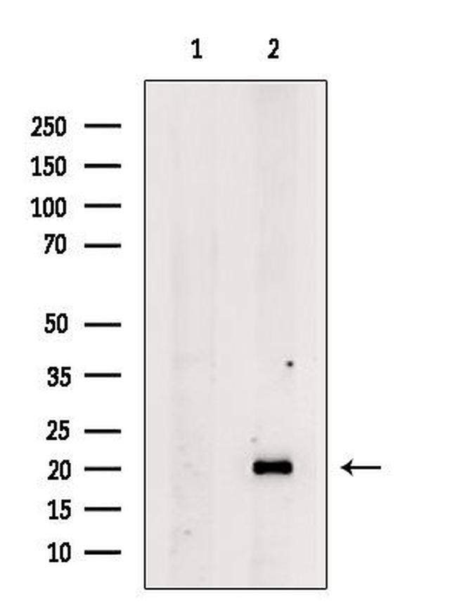 TNNT1 Antibody in Western Blot (WB)