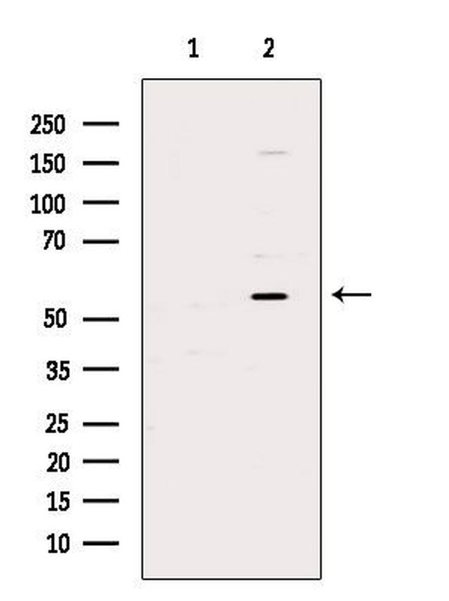 USP14 Antibody in Western Blot (WB)