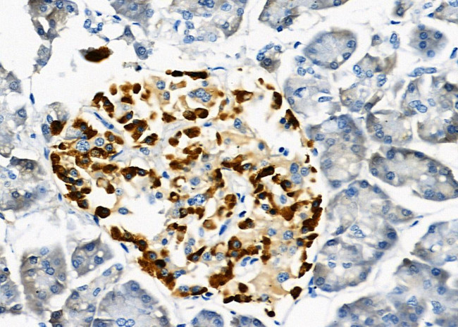 USP16 Antibody in Immunohistochemistry (Paraffin) (IHC (P))