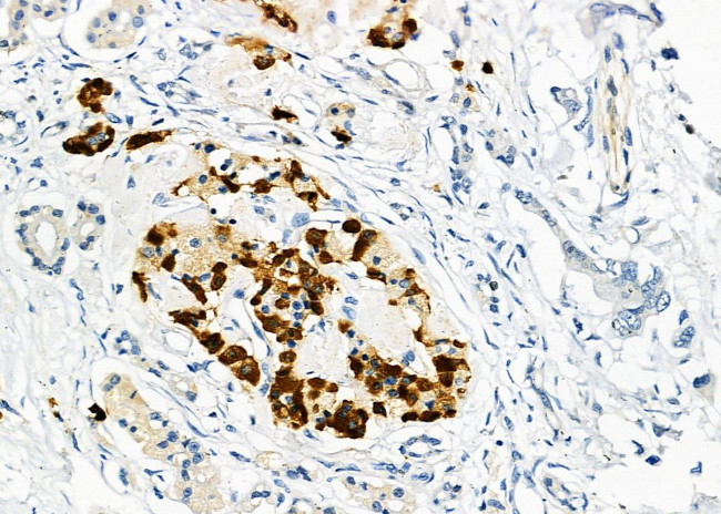 USP16 Antibody in Immunohistochemistry (Paraffin) (IHC (P))