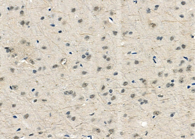 USP16 Antibody in Immunohistochemistry (Paraffin) (IHC (P))