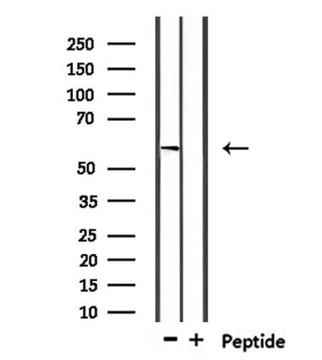 USP17L1 Antibody in Western Blot (WB)