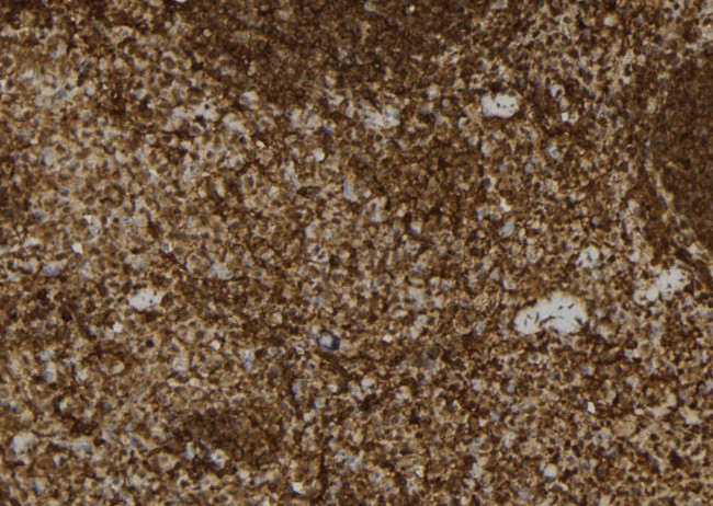 USP31 Antibody in Immunohistochemistry (Paraffin) (IHC (P))