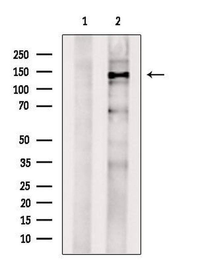 USP31 Antibody in Western Blot (WB)