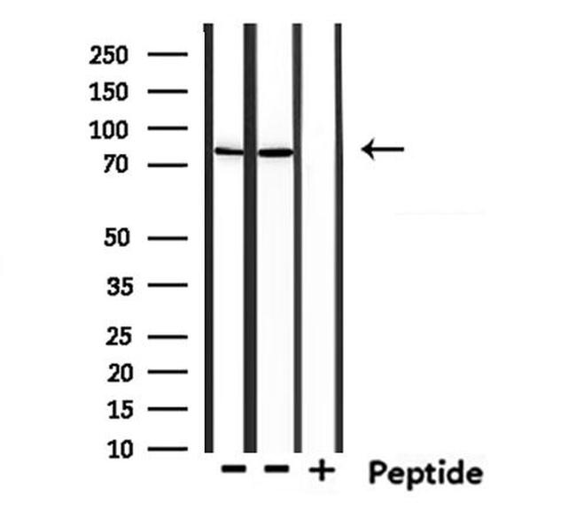 USP51 Antibody in Western Blot (WB)