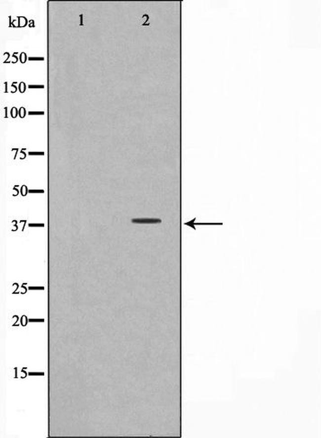 CD226 Antibody in Western Blot (WB)