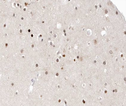 HDAC9 Antibody in Immunohistochemistry (Paraffin) (IHC (P))