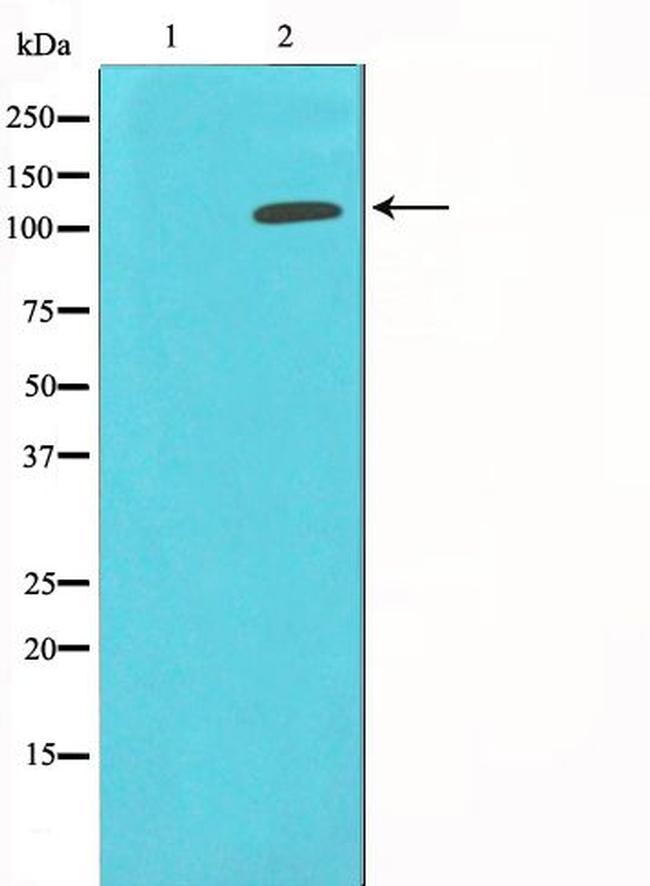 HDAC9 Antibody in Western Blot (WB)