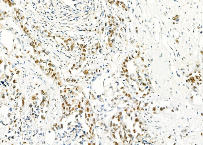 HEXIM1 Antibody in Immunohistochemistry (Paraffin) (IHC (P))