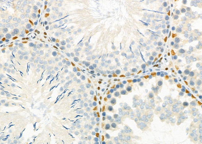 HEXIM1 Antibody in Immunohistochemistry (Paraffin) (IHC (P))