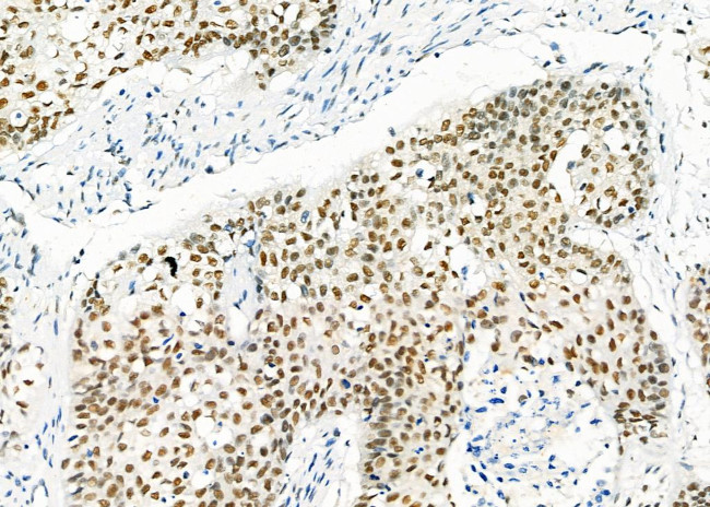 HEXIM1 Antibody in Immunohistochemistry (Paraffin) (IHC (P))