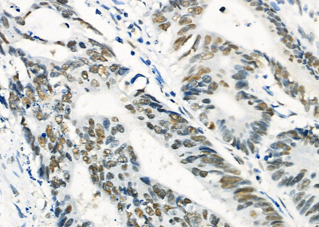 HEXIM1 Antibody in Immunohistochemistry (Paraffin) (IHC (P))