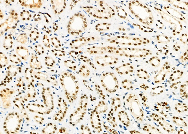 HEXIM1 Antibody in Immunohistochemistry (Paraffin) (IHC (P))