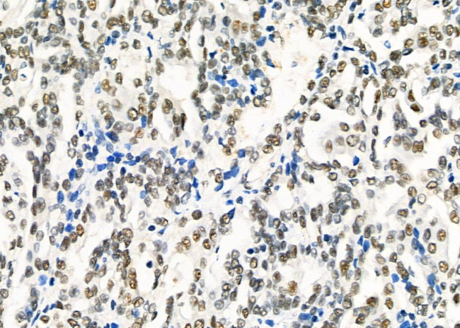 HEXIM1 Antibody in Immunohistochemistry (Paraffin) (IHC (P))