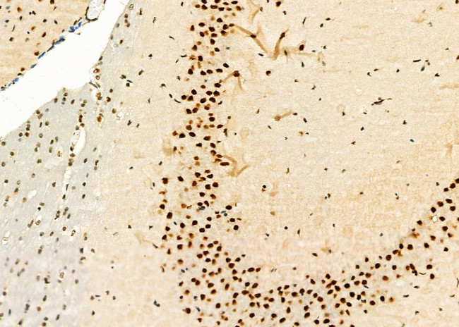 HEXIM1 Antibody in Immunohistochemistry (Paraffin) (IHC (P))