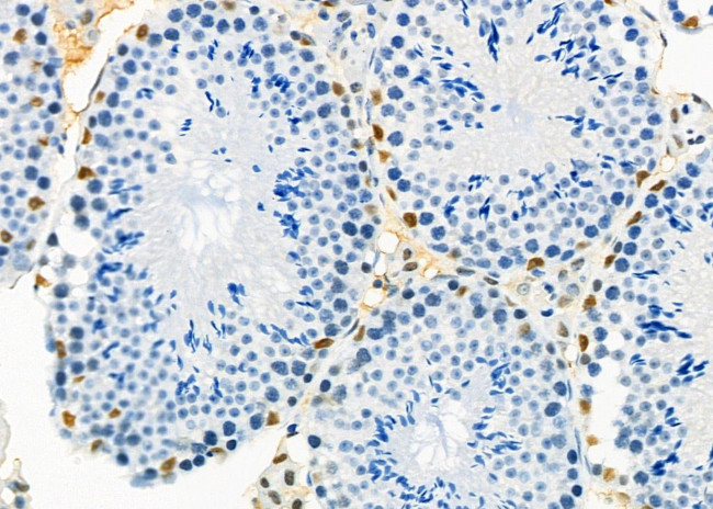 HEXIM1 Antibody in Immunohistochemistry (Paraffin) (IHC (P))