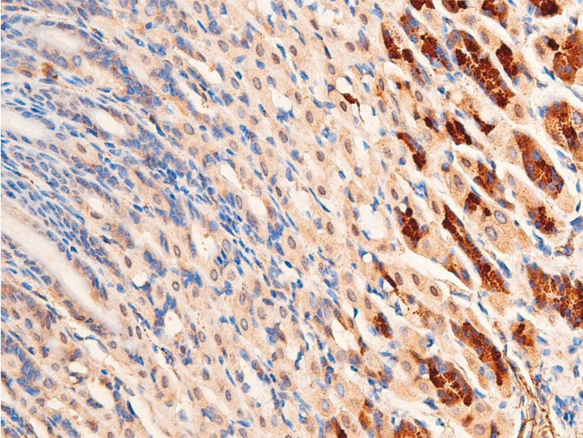 Phospho-Chk1 (Ser296) Antibody in Immunohistochemistry (Paraffin) (IHC (P))