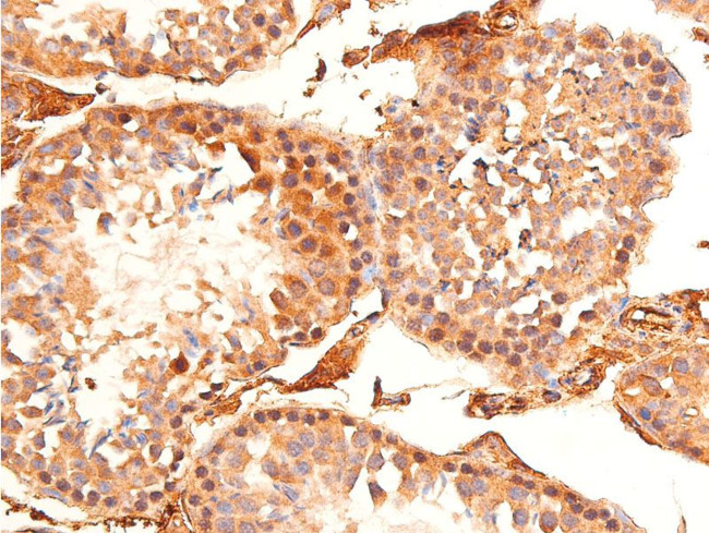 Phospho-Chk1 (Ser296) Antibody in Immunohistochemistry (Paraffin) (IHC (P))