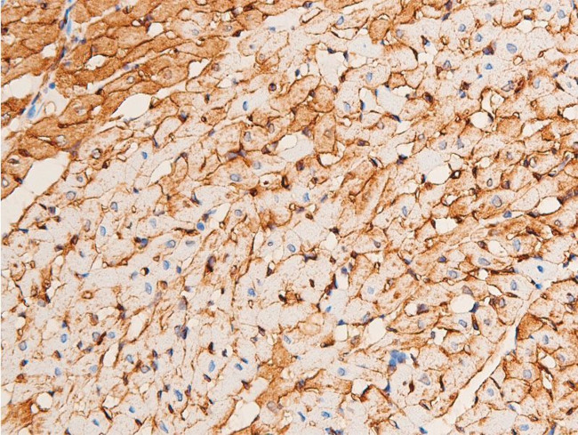 Phospho-Chk1 (Ser296) Antibody in Immunohistochemistry (Paraffin) (IHC (P))