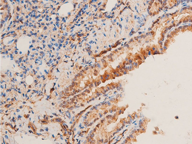 Phospho-Chk1 (Ser296) Antibody in Immunohistochemistry (Paraffin) (IHC (P))