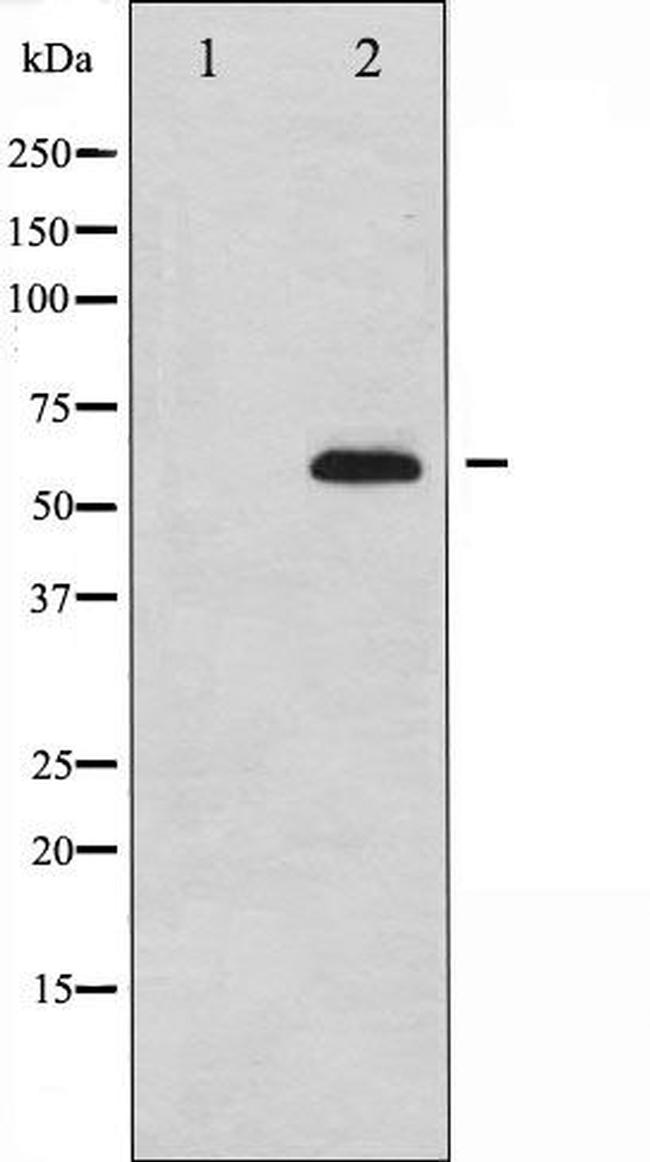 CDC25B Antibody in Western Blot (WB)