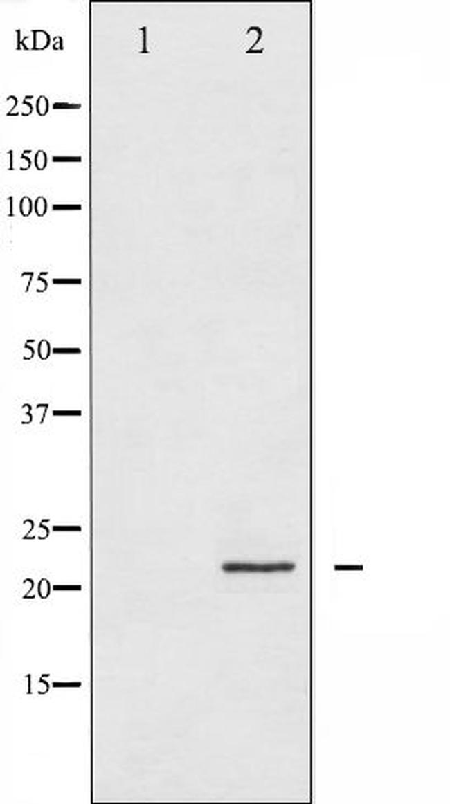 CPI-17 alpha Antibody in Western Blot (WB)