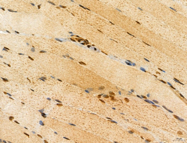 ADRM1 Antibody in Immunohistochemistry (Paraffin) (IHC (P))