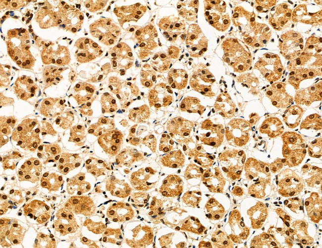 ADRM1 Antibody in Immunohistochemistry (Paraffin) (IHC (P))