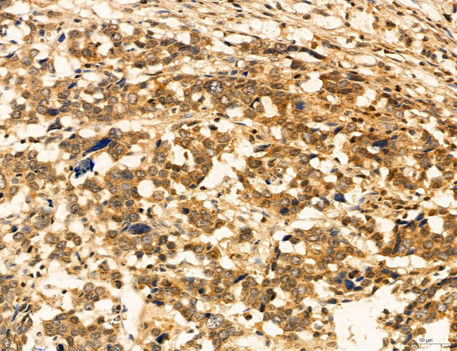 ADRM1 Antibody in Immunohistochemistry (Paraffin) (IHC (P))