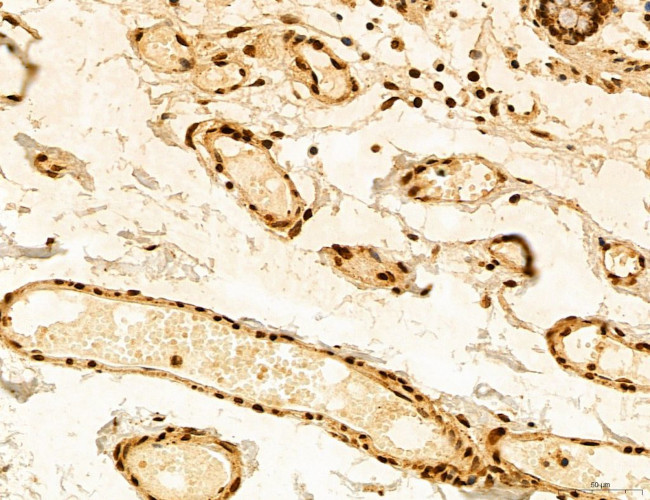 ADRM1 Antibody in Immunohistochemistry (Paraffin) (IHC (P))