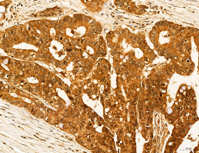 ADRM1 Antibody in Immunohistochemistry (Paraffin) (IHC (P))