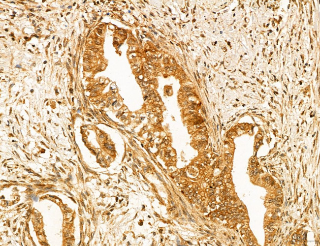 ADRM1 Antibody in Immunohistochemistry (Paraffin) (IHC (P))