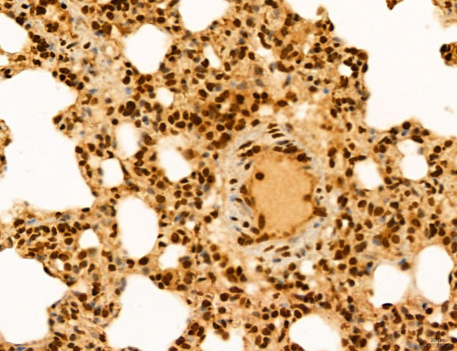 ADRM1 Antibody in Immunohistochemistry (Paraffin) (IHC (P))