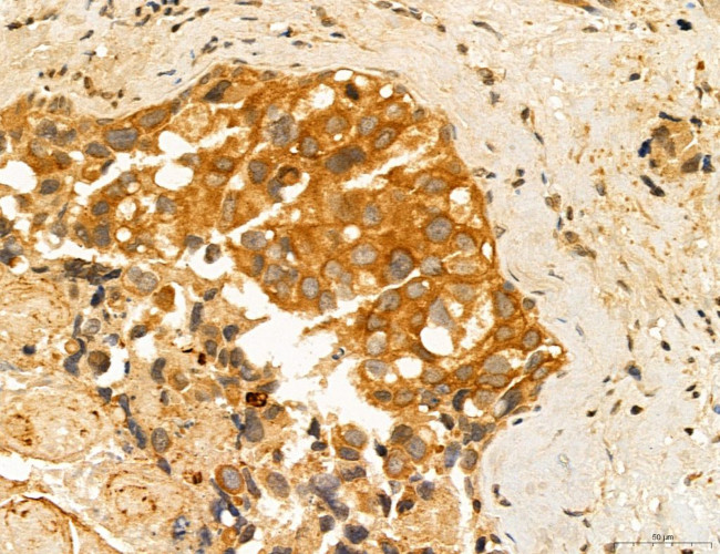 ADRM1 Antibody in Immunohistochemistry (Paraffin) (IHC (P))