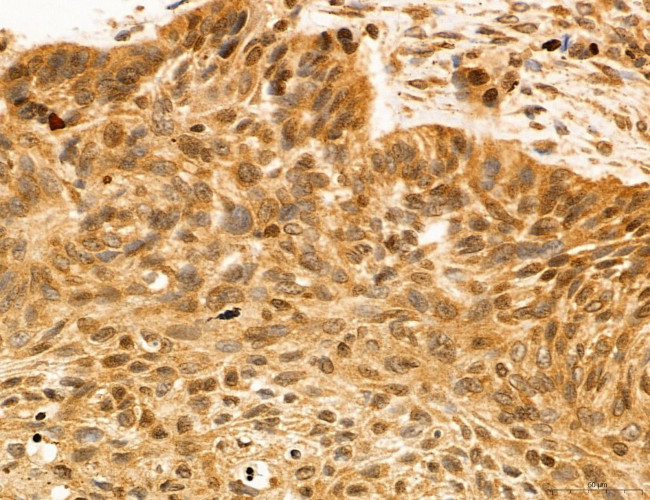 ADRM1 Antibody in Immunohistochemistry (Paraffin) (IHC (P))