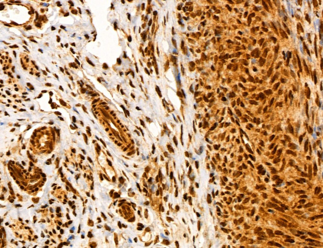 ADRM1 Antibody in Immunohistochemistry (Paraffin) (IHC (P))