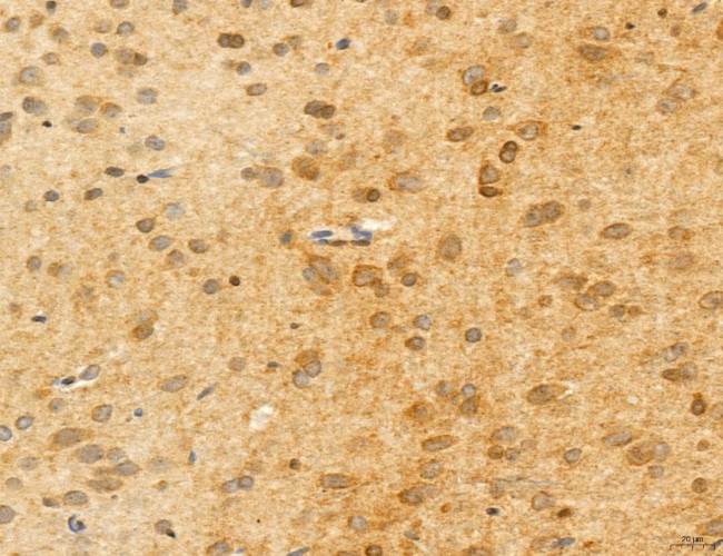 ADRM1 Antibody in Immunohistochemistry (Paraffin) (IHC (P))