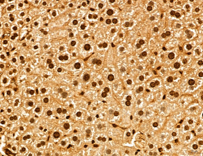 ADRM1 Antibody in Immunohistochemistry (Paraffin) (IHC (P))