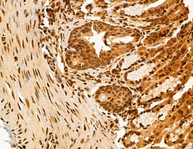 ADRM1 Antibody in Immunohistochemistry (Paraffin) (IHC (P))