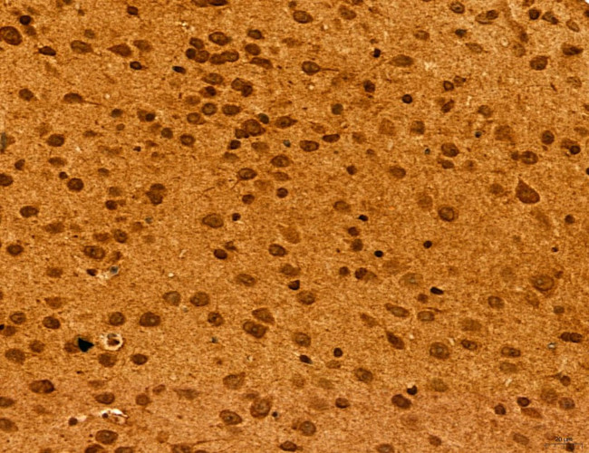 ADRM1 Antibody in Immunohistochemistry (Paraffin) (IHC (P))