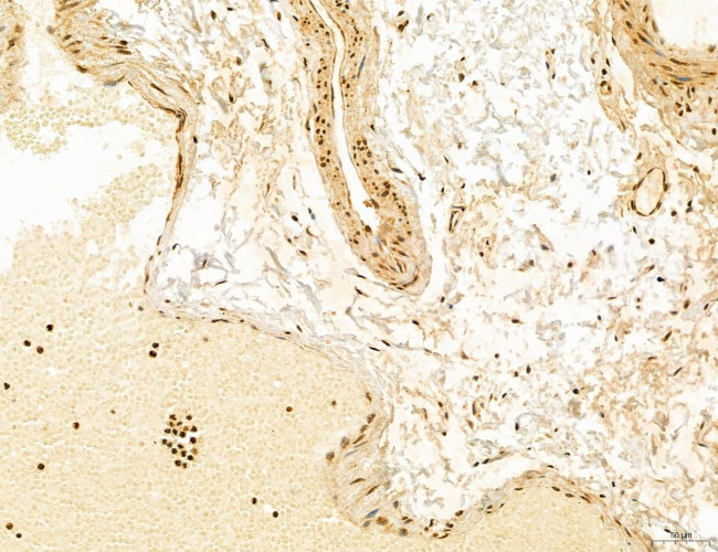 ADRM1 Antibody in Immunohistochemistry (Paraffin) (IHC (P))