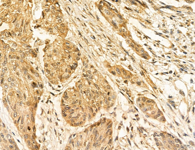 ADRM1 Antibody in Immunohistochemistry (Paraffin) (IHC (P))