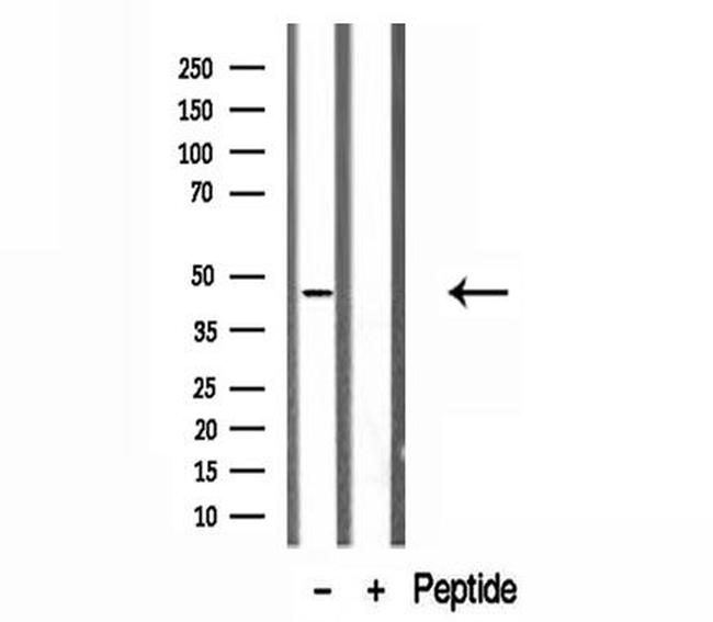 ADRM1 Antibody in Western Blot (WB)